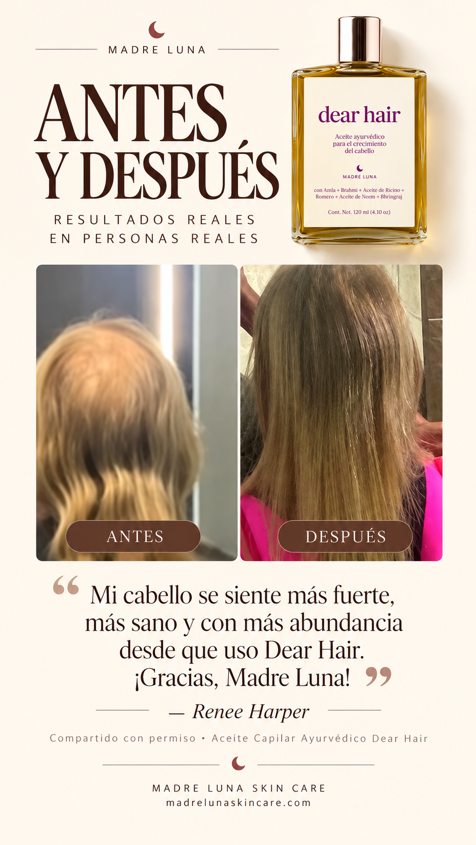 DEAR HAIR - Hair Growth Oil