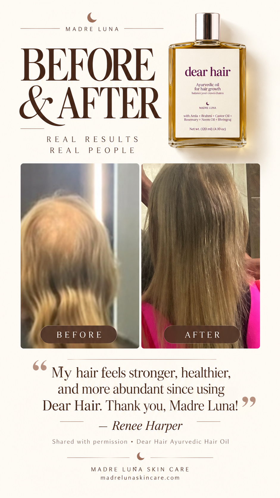 DEAR HAIR - Hair Growth Oil